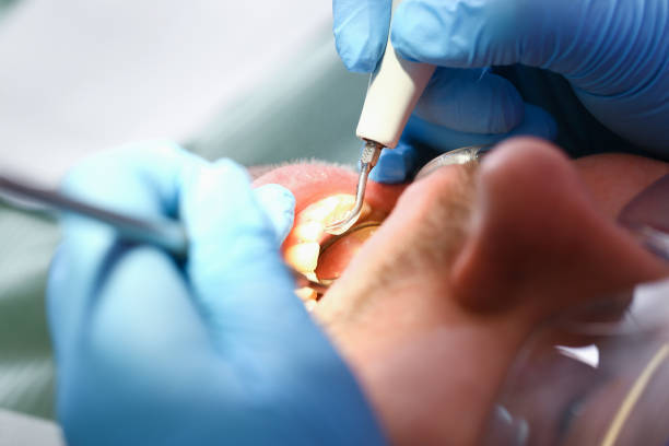 Best Pediatric Emergency Dentist in Orange, TX