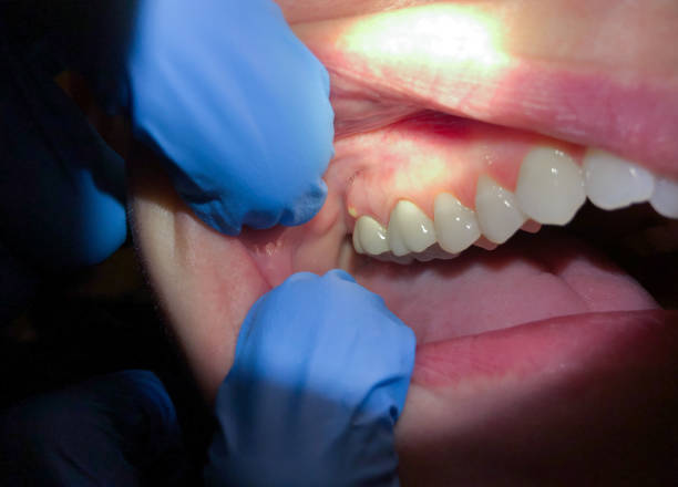 Best Emergency Dentist for Special Needs Patients in Orange, TX